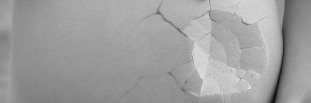 Pancione di una donna incinta: è rotto come un guscio d'uovo